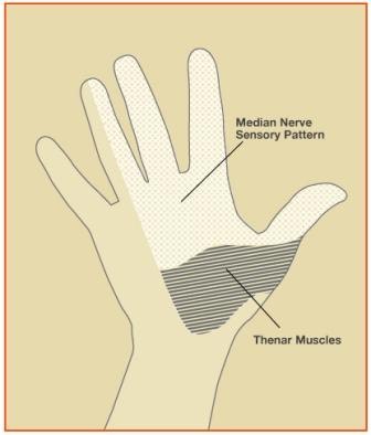 CarpalTunnel2