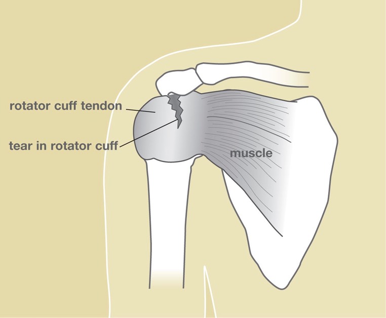 Rotator_Image2