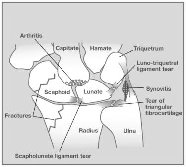 WristArthroscopy1